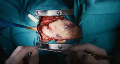 Still from The Killing of a Sacred Deer (2017) that has been tagged with: gore & surgery
