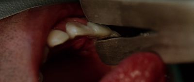 Still from Oldboy (2003) that has been tagged with: dentist